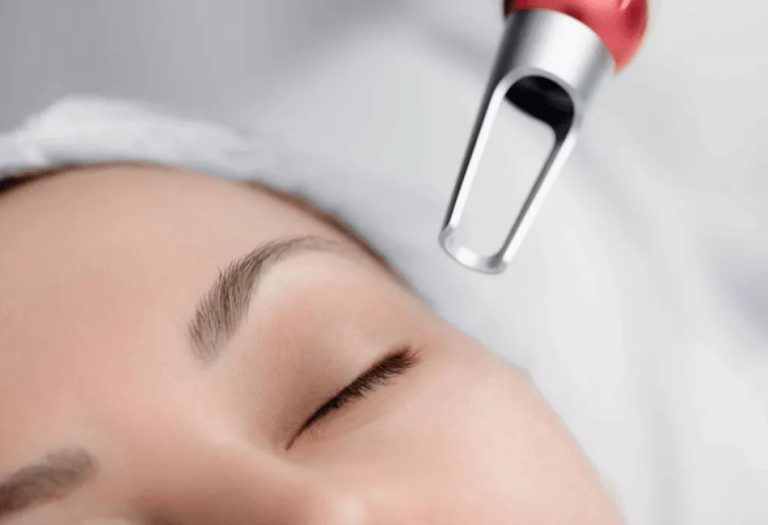 How Many Sessions of Pico Laser Do you Need?
